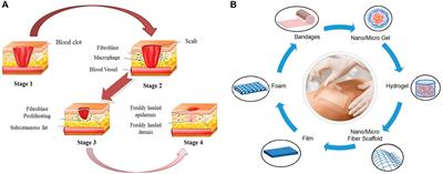 Latest Advances on Bacterial Cellulose-Based <mark class="highlighted">Antibacterial Materials</mark> as Wound Dressings